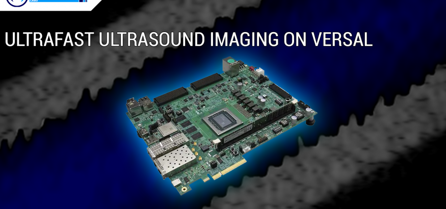 ultrafast ultrasound imaging on Versa